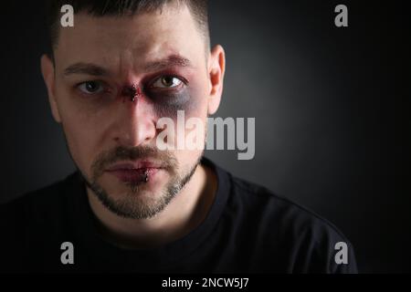 Man with facial injuries on dark background, space for text. Domestic violence victim Stock Photo