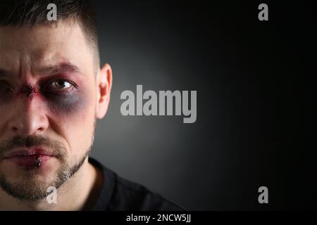 Closeup view of man with facial injuries on dark background, space for text. Domestic violence victim Stock Photo
