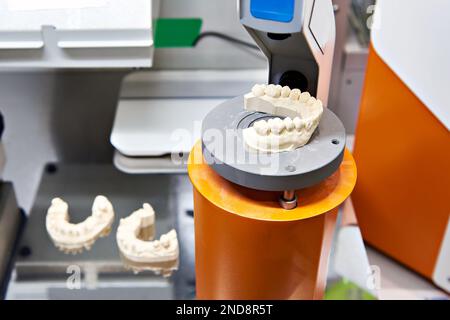 Plaster cast for the manufacture of dentures Stock Photo