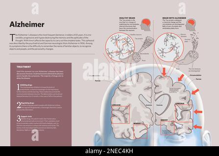Infographic of the brain. [Adobe InDesign (.indd); 4960x3307] Stock ...