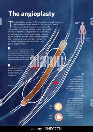 Heart In Indesign Infographic about the inside of the heart. [Adobe InDesign (.indd ...