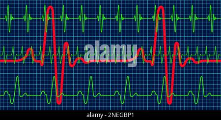 Illustration of the abstract cardiogram charts set Stock Vector