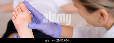 Doctor examining foot of child with red itchy rashes in clinic closeup Stock Photo