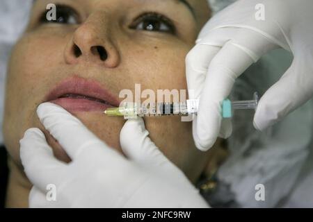 Leila Rosalia receives free lip filling injections in Rio de