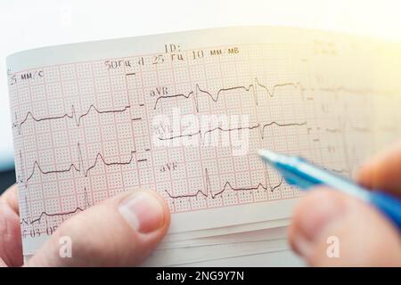 Electrocardiogram. Hand in medical glove holding a ballpoint pen. Close up Stock Photo