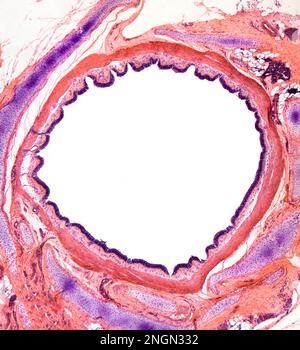 Human brochal section, bronchi are the airways that lead from the trachea into the lungs Stock Photo