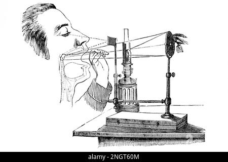 Laryngoscope. Instrument for examination of the larynx. Antique illustration from a medical book. 1889. Stock Photo