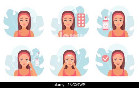 Acne treatment set vector illustration. Cartoon medical infographic collection with cleaning routine of girl for care of oily skin with blotch and pimple, cosmetic skincare procedures and medicines Stock Vector