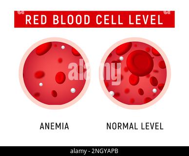 Anemia problem circulatory iron body diagram background. Anaemia biology blood isolated medical normal icon. Stock Vector