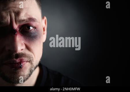 Closeup view of man with facial injuries on dark background, space for text. Domestic violence victim Stock Photo