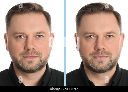 Collage with photos of man before and after eyebrow modeling on pink ...