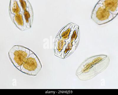 Amphora sp. algae under microscopic view, Diatoms, phytoplankton, fossils, silica, golden yellow algae Stock Photo