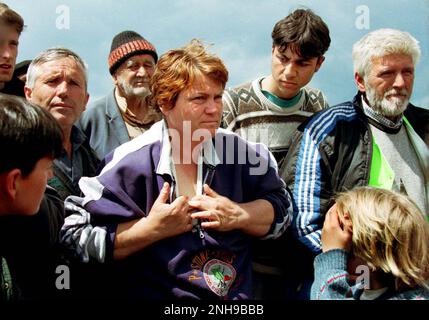 Albanian-Kosovan Woman shows scar resulting from bullet wound received whilst being ethnically cleansed from Kosovo. Brazda refugee camp in Macedonia April 1999. The camp was run by NATO but  turned over  to UNHCR. Macedonia. Picture garyrobertsphotography.com Stock Photo