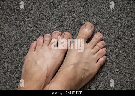 Dirty feet and toes of the girl close-up Stock Photo - Alamy