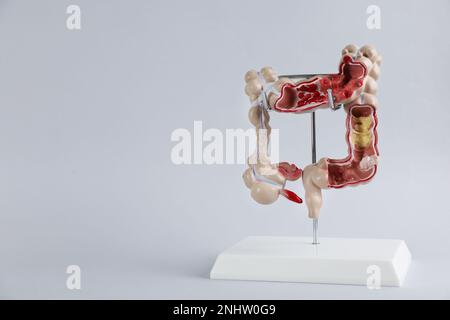 Human colon model on light background. Space for text Stock Photo - Alamy
