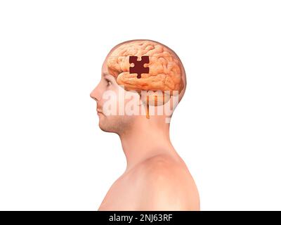 Brain shaped white jigsaw puzzle on white background, a missing piece of the brain puzzle, mental health and problems with memory, 3d render Stock Photo