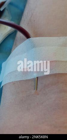 young blood donor with large needle stuck in forearm during donation at hospital Stock Photo