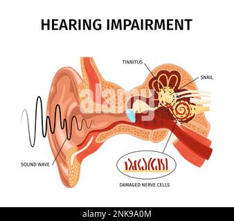 realistic-anatomy-ear-tinnitus-composition-with-sound-internal-organs