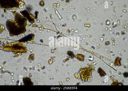 soil microorganisms in a soil sample, soil fungus and bacteria on a ...