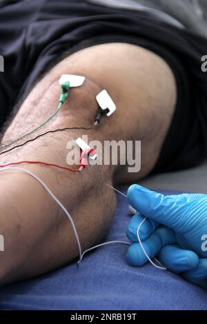 Electromyography EMG and Somatosensory Evoked Potential PEV of lower extremities, neurophysiological test applies electrical stimuli near the nerves Stock Photo