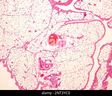 Very low magnification light microscope micrograph of white adipose tissue or fat, stained with hematoxylin and eosin. Adipocytes (fat cells) contain Stock Photo