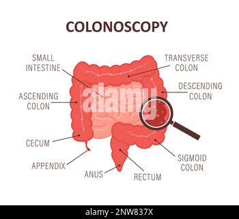 Colonoscopy concept. Intestine exam and treatment. Bowel polypectomy procedure. Anatomy of colon. Prevention of cancer. Vector illustration in flat Stock Vector