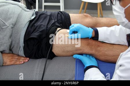 Electromyography EMG and Somatosensory Evoked Potential PEV of lower extremities, neurophysiological test applies electrical stimuli near the nerves Stock Photo