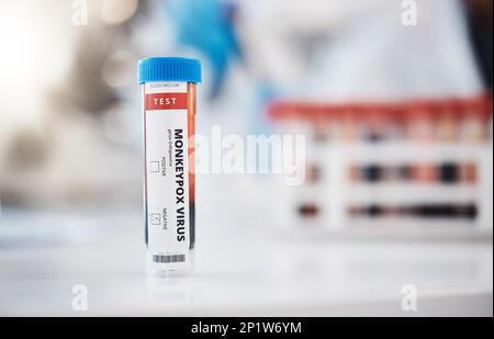 Monkeypox virus test. One sample tube with blood on others, closeup ...
