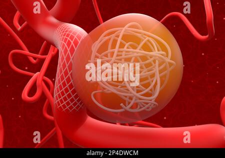 Aneurysm treat with mesh stent and coils - 3d illustration closeup view Stock Photo