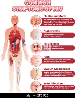 Informative poster of common symptoms of HIV illustration Stock Vector