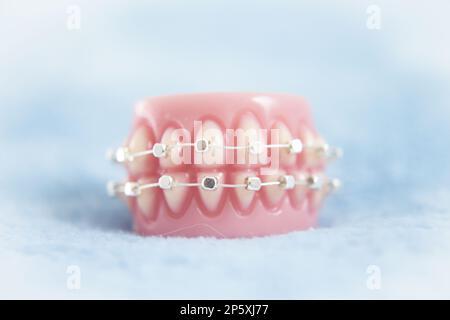 Metal orthodontic denture base. No people Stock Photo