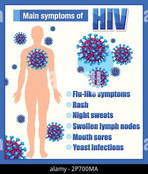 Informative poster of main symptoms of HIV illustration Stock Vector ...