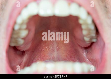 Back of the throat, roof of the mouth macro close up view of Caucasian male pharynx. Stock Photo