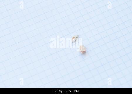 tooth decay. badly decayed extracted teeth Stock Photo - Alamy