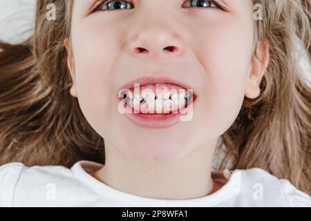 Happy smiling child portrait. Dental care, oral health. Close-up of teeth. Little todler attractive lovely sweet curious cheerful girl laughs with her Stock Photo