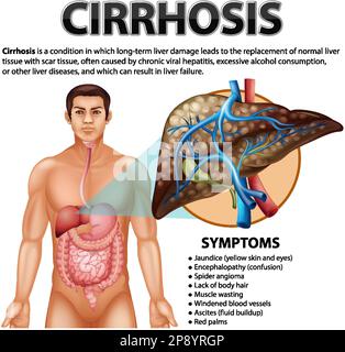 Alcoholism visual data 7