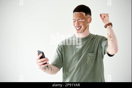 Oh yeah, I won. Studio shot of a young man with vitiligo cheering while using a cellphone against a white background. Stock Photo