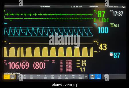 Modern anesthesia vital signs monitor displaying real-time patient parameters in an operating room. Medical technology concept representing anesthesia Stock Photo