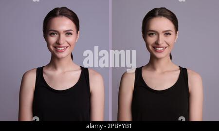 Collage with photos of beautiful young woman before and after using mattifying wipes on grey background Stock Photo