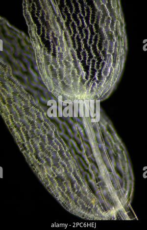 Microscopic view of peat moss (Sphagnum) detail. Darkfield illumination. Stock Photo