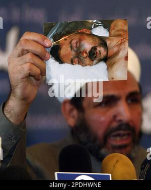 ** FILE ** ** EDITORS NOTE GRAPHIC CONTENT ** Association of Muslim Scholars spokesman Abdul Salam al-Kubaisi, shows an undated picture of an allegedly tortured man, during a press conference in Baghdad, Iraq, in this Nov. 17, 2005 file photo. According to al-Kubaisi the man shown in the picture was arrested by Interior Minister special forces and died during his detention. Iraq's government missed a two-week deadline Wednesday to complete an investigation into torture allegations at an Interior Ministry lockup, a probe which Amnesty International warned may show a pattern of abuse of prisoner