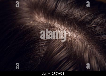 Hair and head skin close up Stock Photo - Alamy