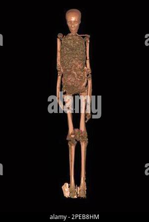 Egypt, CT scan of Tutankhamun Stock Photo - Alamy