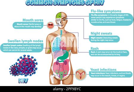 Informative poster of common symptoms of HIV illustration Stock Vector