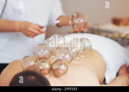 A picture of a man having cupping therapy Stock Photo