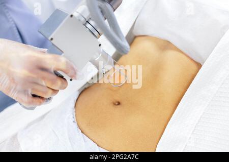 Removing scars with laser. Extreme close up of hand of doctor or cosmetologist in transparent glove, part of apparatus, red laser beam and lower abdom Stock Photo