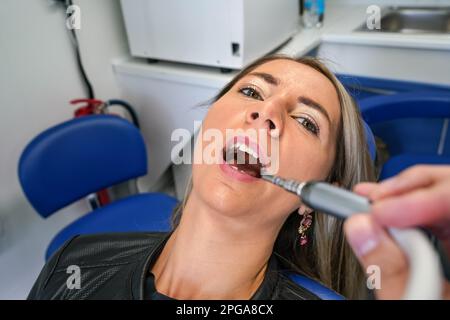 Young woman posing with her mouth open at dentist chair, dental tool near her teeth, first person view Stock Photo