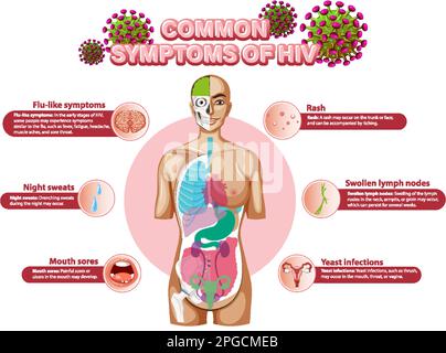 Informative poster of common symptoms of HIV illustration Stock Vector