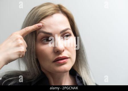 woman shows drooping eyelid for plastic surgery Stock Photo - Alamy