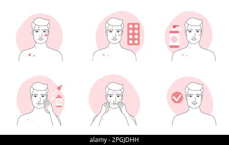 Acne treatment for man infographic line icon set vector illustration. Hand drawn outline guys treat rash of pimples with pills, puberty facial problem, apply skincare liquid products, ointment on skin Stock Vector